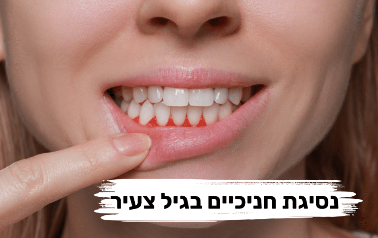 מדוע מתרחשת נסיגת חניכיים בגיל צעיר